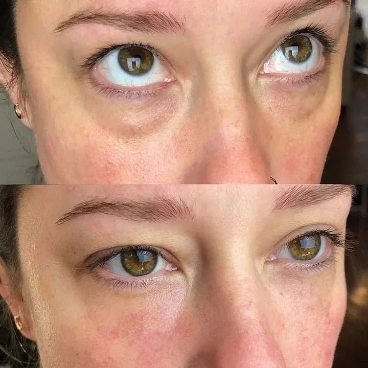 Efecto buena cara: Despierta tu mirada y borra el cansancio en 10 minutos. - Mylia Care
